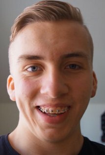 Jonas Berg