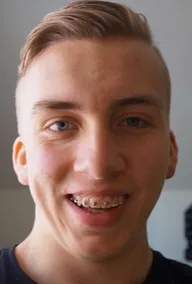 Jonas Berg
