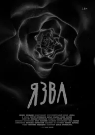 Язва