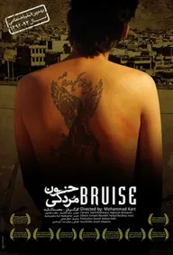 Bruise
